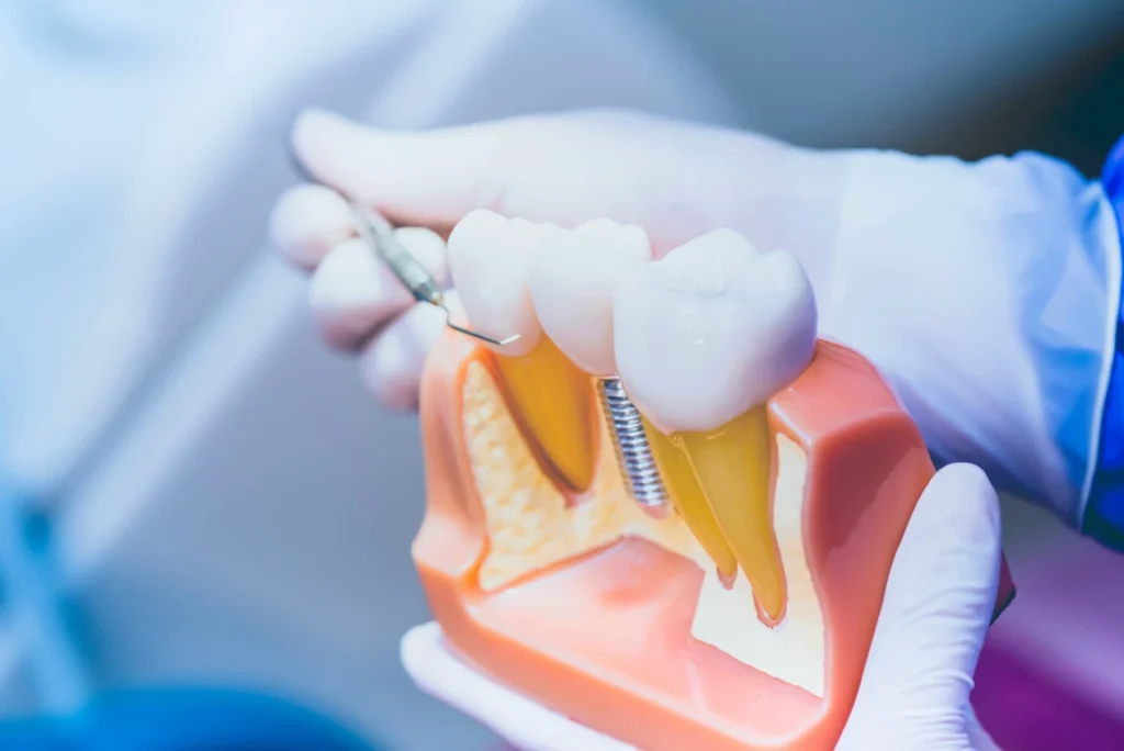 Podniesienie dna zatoki szczękowej Wrocław